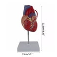 thumbnail image 4 of MOMOJIA Human Heart Anatomy Model for Cardiology Study Demonstrating Heart Bypass, 4 of 8