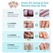 Toenail Fungus Treatment Extra Strength, Nail Repair For Damaged Nails, 32 Pcs Fungal Nail Patches, Nail Fungus Treatments Patches Not Easy to Fall Off