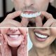 thumbnail image 3 of Smile Dental False Teeth Cover Perfect Smile Veneers Comfort Fit Flex Denture Teeth, 3 of 4