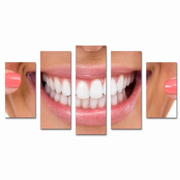 Juego de Cuadros Decorativos, Sonrisa Perfecta y Radiante, Estilo Estética Dental, 5 Piezas, Ideal para Clínicas de Diseño de Sonrisa, 150x80cm