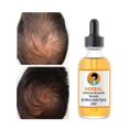 thumbnail image 1 of Sérum de jengibre para el crecimiento del cabello, para la caída del cabello y la caspa, tratamiento para el crecimiento del cabello, 59 ml (2 oz), para hombres y mujeres., 1 of 5