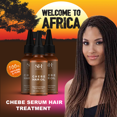thumbnail image 2 of Productos para el crecimiento del cabello Sevich para mujeres, África, Traction, Alopecia, Chebe, aceite para el crecimiento del cabello, tratamiento anticaída, cuidado capilar para espesar el cabello, 2 of 5