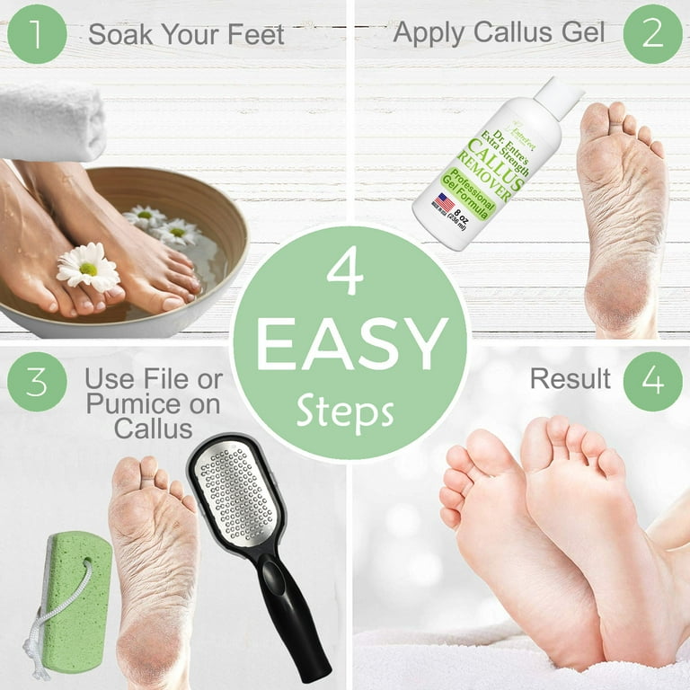 Callus Remover for Feet with Extra Strength Gel & Foot Pumice Stone Set -  Easy Way to Remove Hard Calluses & Dead Skin Build-Up - Professional  at-Home