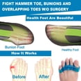 thumbnail image 3 of Skywee Gel Toe Separators, Gel Toe Stretcher for Foot Yoga, Bunion Correctors for Relaxing Toes, Bunion Relief, Hammer Toe, 3 of 8