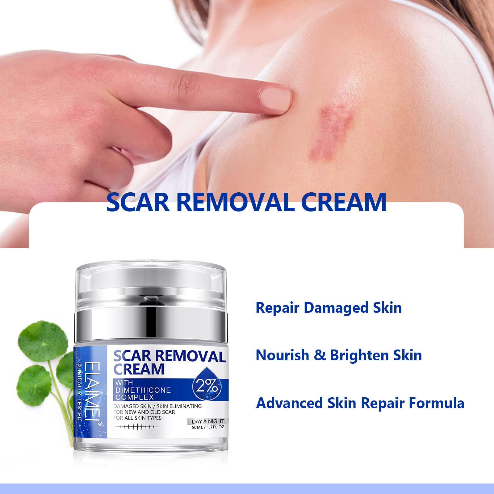 30g Scar Removal Face Body Creams Stretch Marks Remove Burn Cut Surgery  Acne Scars Treatment Smooth Brighten Clear Soften Care - Walmart.com
