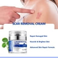 Scar Removal Cream 2022 Upgraded Advanced Scar Treatment Gel for