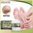 thumbnail image 3 of EELHOE Hand Feet Care Cream Anti-Drying Crack Foot Cream Heel C, 3 of 5