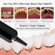 thumbnail image 4 of Usb Electric Tooth Cleaner Dental Scaler Stain Remover Teeth Cleaning Kit Rechargeable, 4 of 5
