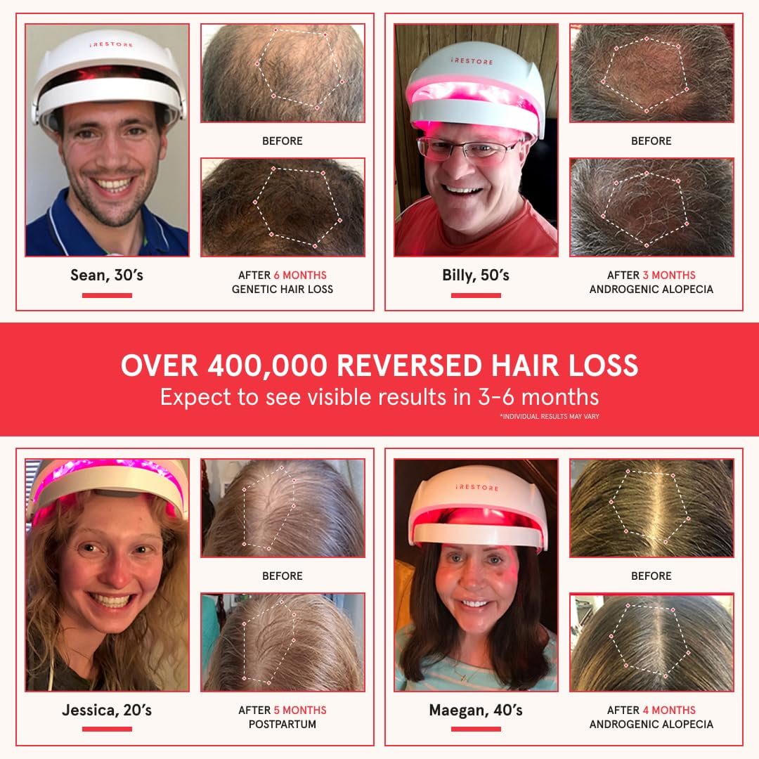 iRestore Laser Hair Growth System FDA Cleared Hair Loss Treatment for Men and Women