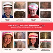 iRestore Laser Hair Growth System FDA Cleared Hair Loss Treatment for Men and Women