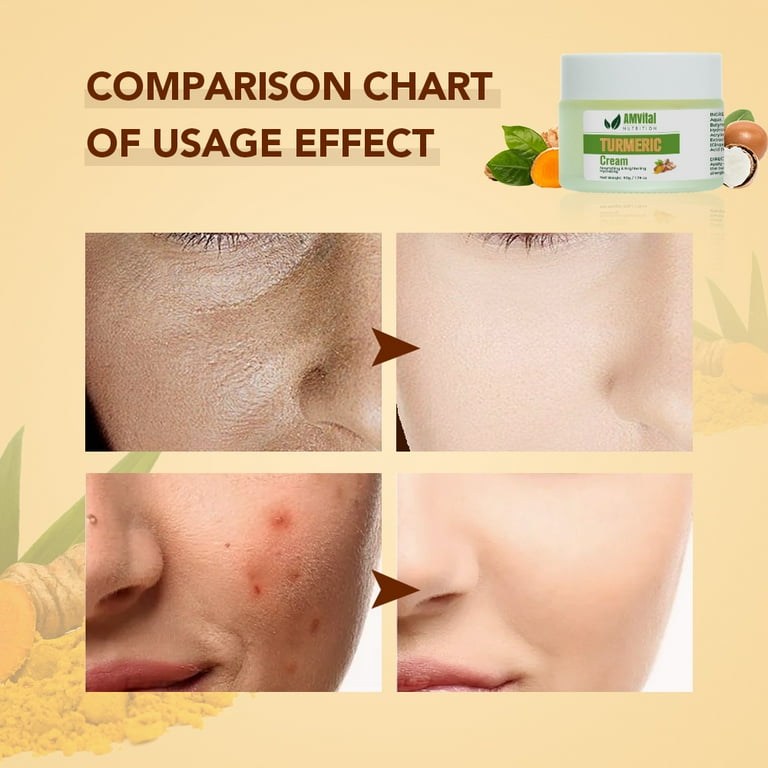 Amvital Turmeric Cream for Glow - Natural Turmeric Moisturizer - Brightening, Soothing, and Hydrating for All Skin