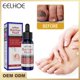 thumbnail image 1 of Eelhoe Nail Repair Liquid Care Hands and Feet Nail Repair Moisturizing Cleansing To Gray Nail Repair Liquid zhangyuxiang LED, 1 of 2