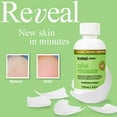 thumbnail image 5 of ProLinc Callus Eliminator - 4 oz, 5 of 7