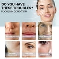 thumbnail image 4 of ammoon Protein Lift Line Skin V-Face Firming Lifting Sagging Facial Blue, 4 of 7