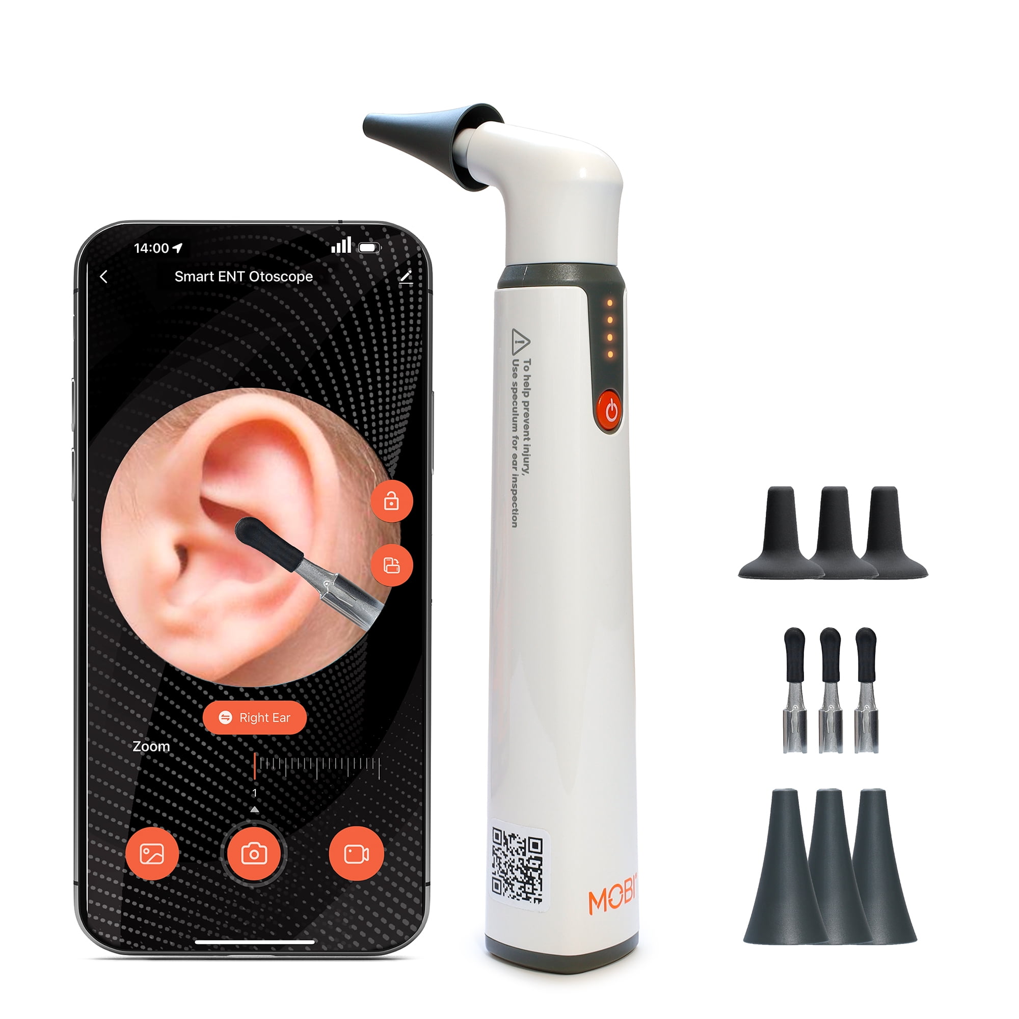 Mobi Ear, Nose & Throat Smart baby Otoscope Jr. with 1080P HD Camera & 6 LED Lights,1-pack