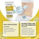 thumbnail image 3 of Waist Acne Gel, Waist Skin Gentle Cleaning Acne Daily Skin Moisturizing Care Gel, 3 of 5