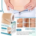 thumbnail image 5 of Pumkot Silicone Scar Tape Roll 1.6”x60”(1.5M) - For Surgical Scars, Keloid, C-Section & Burns, 5 of 8