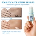 thumbnail image 3 of Silicone Scar Stick, Silicone Scar Sheets for Surgical Scars, Stretch Marks Removal, For Face and Body, 10g*2, 3 of 9