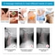 thumbnail image 5 of Masajeador de vértebra cervical, masajeador eléctrico de vértebra cervical Cuello Hombro Alivio del dolor Instrumento de fisioterapia utilizado para masaje de piernas, masaje de brazosBlanco) Khall 1.4112E+12, 5 of 6