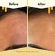 thumbnail image 4 of Sérum facial ECZEMA HONEY, nutritivo e hidratante diario, 30 ml, 4 of 6