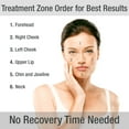thumbnail image 4 of Silk'n Titan Anti Aging Skin Tightening Device, 4 of 4