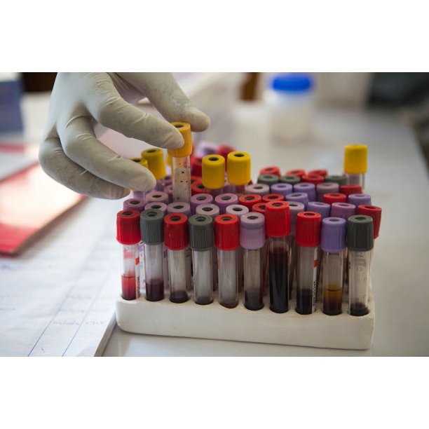 HIV aids testing in Zimbabwe South Africa Poster Print by VWPics