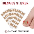thumbnail image 2 of Parche Adhesivo Para Uñas Encarnadas, 50 Uds., Corrector De Parche Para Uñas De Los Pies, Herramientas De Pedicura, Parche Corrector De Uñas Encarnadas Para Hombres Y Mujeres Yuarrent CE006357-00, 2 of 6