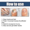 thumbnail image 5 of Grey Nail Repair Solution Anti-fungus Antibacterial Onychomycosis Removal Soft Gr, 5 of 5