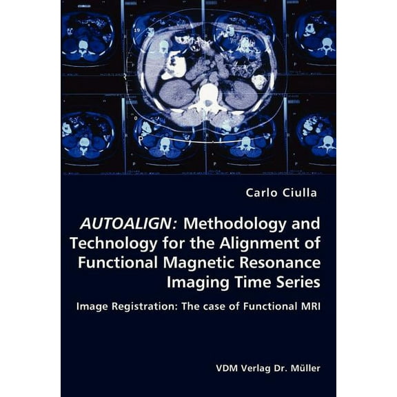 Autoalign: Methodology and Technology for the Alignment of Functional Magnetic Resonance Imaging Time Series (Paperback)