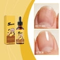 thumbnail image 4 of Nail Care Liquid for Damaged and Fragile Nail, Thickening Toughening Barb Nourishing Shining Oil 1 oz, 4 of 8