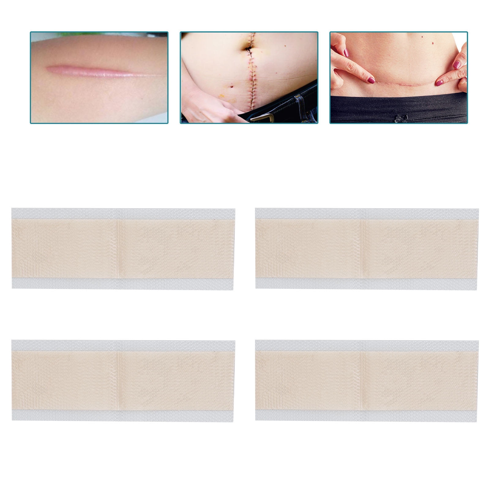 Spptty Skin Concealing Tape,Scar Cover,4 Pcs Scar Covering Sticker