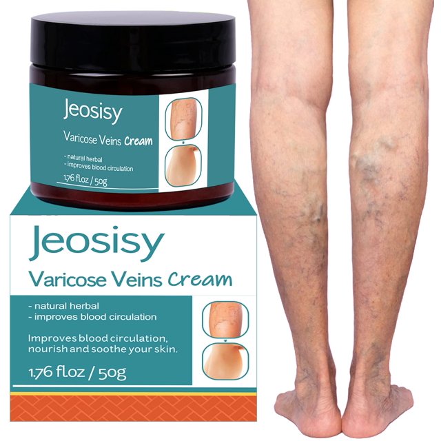 Crema para varices Jeosisy para piernas, varices y arañas vasculares