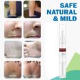 thumbnail image 1 of Salud Natural Skin Tag Remover12 Horas Mole Genital Verruga Pie Corn Removal 3ml (Buy 2 get 1 free), 1 of 9