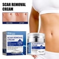thumbnail image 2 of Crema reparadora Cicatrices Crema aclarante Crema reparadora de cicatrices Crema reparadora de piel Natural, 2 of 8