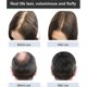 thumbnail image 5 of 2025 Ginger Plant Extract Anti-hair Loss Hair Shampoo, 2024 New Ginger Plant Extract Anti-hair Loss Hair Shampoo, Ginger Shampoo For Hair Growth, 5 of 5