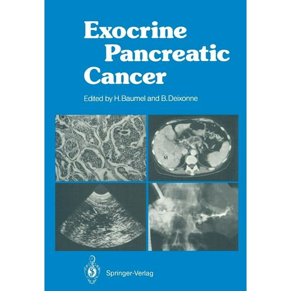 Exocrine Pancreatic Cancer, (Paperback)