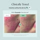 thumbnail image 5 of Tónico facial PURITO Centella 200 ml Hidratación calmante K-Beauty, 5 of 6