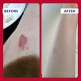 thumbnail image 2 of Emuaidmax First Aid Ointment Maximum Strength Treatment Travel Size 2 Pack 0.35 oz, 2 of 8