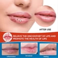 thumbnail image 4 of New Herbal Lip Cream Cold Sores Treatment Anti Lip Wrinkles Chapped Moisturizing, 4 of 5