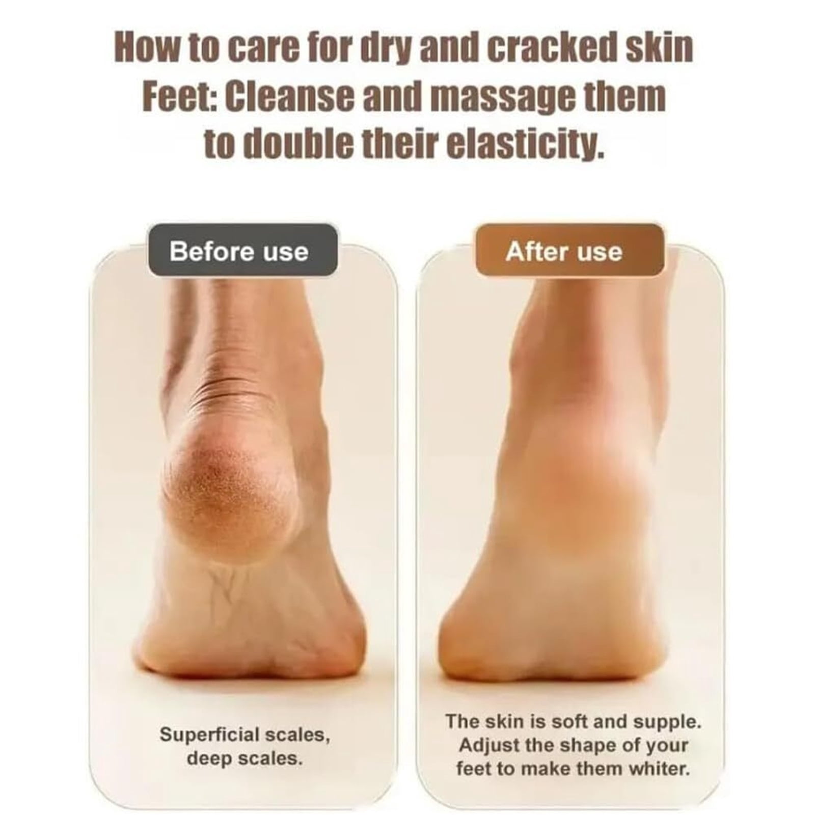 Electric Callus Remover for Feet, Portable Rechargeable Foot Repair and Grinding Device with Digital Display, Heel Polisher File for Men Women Dry Callus Dead Skin