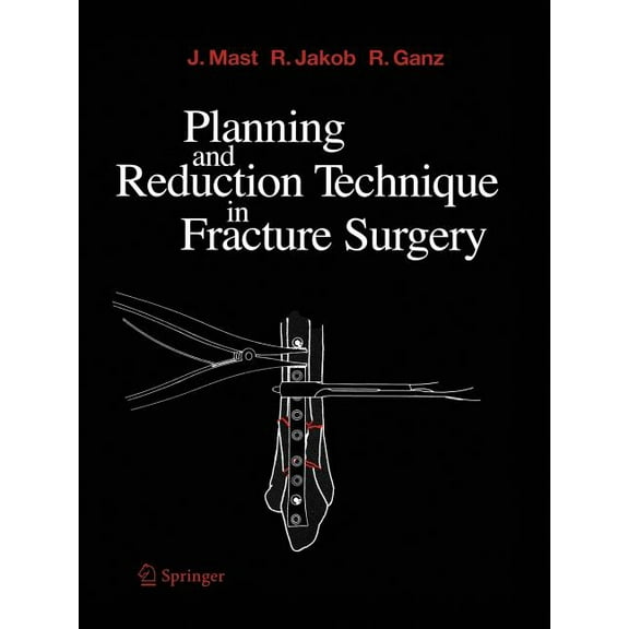 Planning and Reduction Technique in Fracture Surgery, (Paperback)
