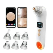 INSMART Blackhead Remover Vacuum, Black Head Extractions Tool with Camerafor, USB Interface Type Pore Vacuum, Men and Women Pore Cleaner, 6 Suction Heads & 3 Adjustment Modes