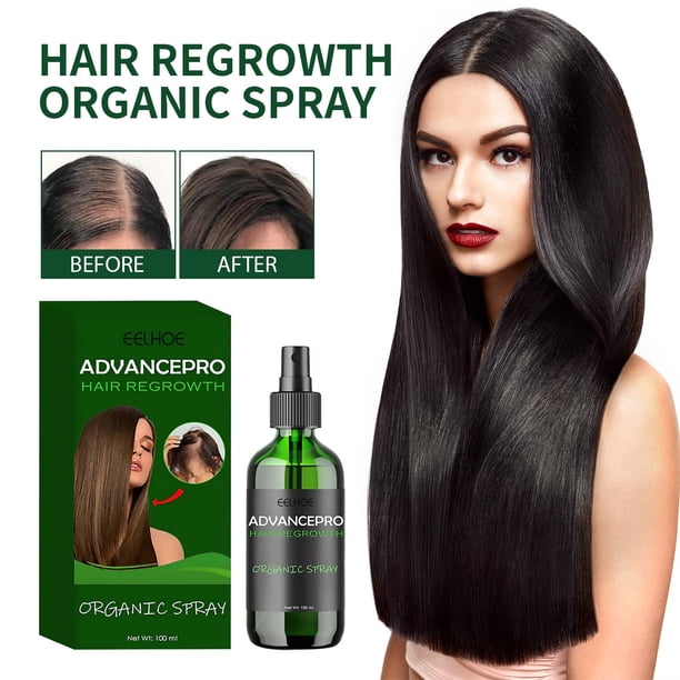 Fiudx Spray Capilar, Esencia Natural para El Crecimiento, Fórmula para Cuidado Del Folículo Piloso, Solución Hidratante para Cuero Cabelludo, Uso Diario Antes de Dormir, para Cabello Seco o Húmedo, T