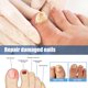 thumbnail image 2 of Tratamiento para hongos en las uñas de los pies, 32 unidades. Tratamiento reparador de uñas, restaura la apariencia de uñas descoloridas o dañadas., 2 of 5