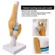 thumbnail image 2 of Modelo AnatóMico De ArticulacióN De Rodilla Con Ligamentos, TamañO Natural, DemostracióN DidáCtica OrtopéDica, 2 of 10