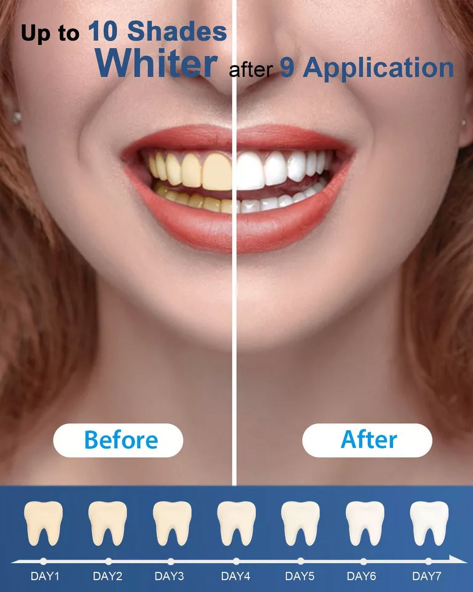 MySmile Teeth Whitening Gel Refill, Carbide Peroxide Whitening Gel for LED Teeth Whitening Kit, Non-Sensitive & Enamel Safe, Not Include Teeth Whitening Light, 10Pcs x 3ml Economy Packaging