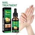thumbnail image 4 of Ginger Nail Treatment Nail Support Nail Care, 7days Nail Treatment, Ginger Nail Growth Serum, Ginger Cuticle Care Oil for Nails (1pc), 4 of 9