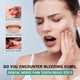 thumbnail image 3 of Esencia de cuidado bucal, Liwei spray calmante bucal 25ml alivia encías doloridas para hombres y mujeres Liwei Esencia de cuidado bucal, 3 of 6