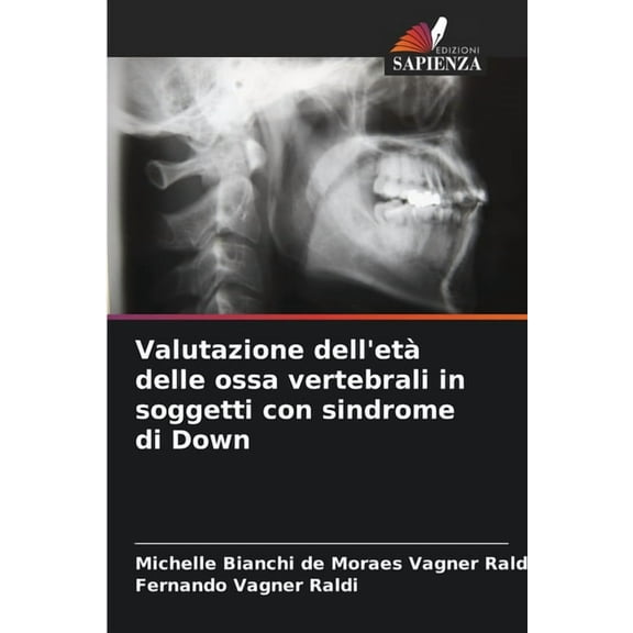 Valutazione dell'età delle ossa vertebrali in soggetti con sindrome di Down, (Paperback)