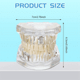 Disease Teeth Model Dental Typodonts Implant Teeth Model with Removable